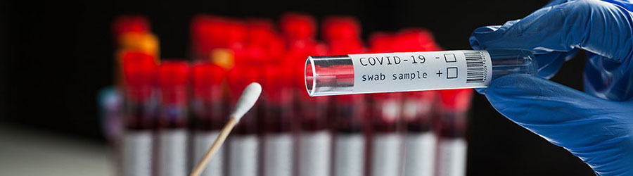 Covid-19 Testing